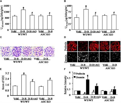 D-Ribose Induces Podocyte NLRP3 Inflammasome Activation and Glomerular Injury via AGEs/RAGE Pathway